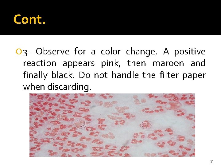 Cont. 3 - Observe for a color change. A positive reaction appears pink, then