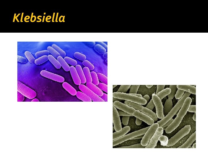 Klebsiella 