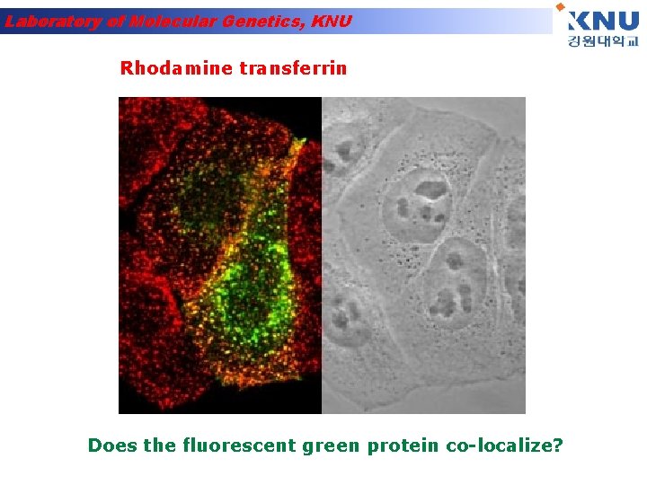 Laboratory of Molecular Genetics, KNU Rhodamine transferrin Does the fluorescent green protein co-localize? 