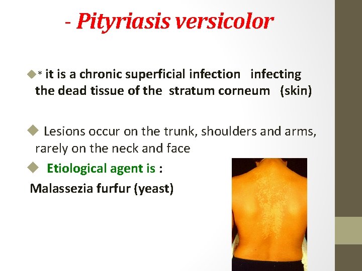 - Pityriasis versicolor u* it is a chronic superficial infection infecting the dead tissue