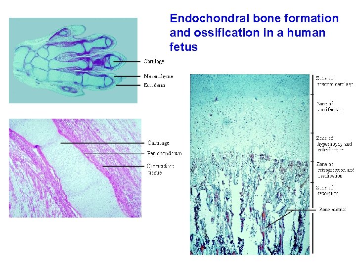Endochondral bone formation and ossification in a human fetus 