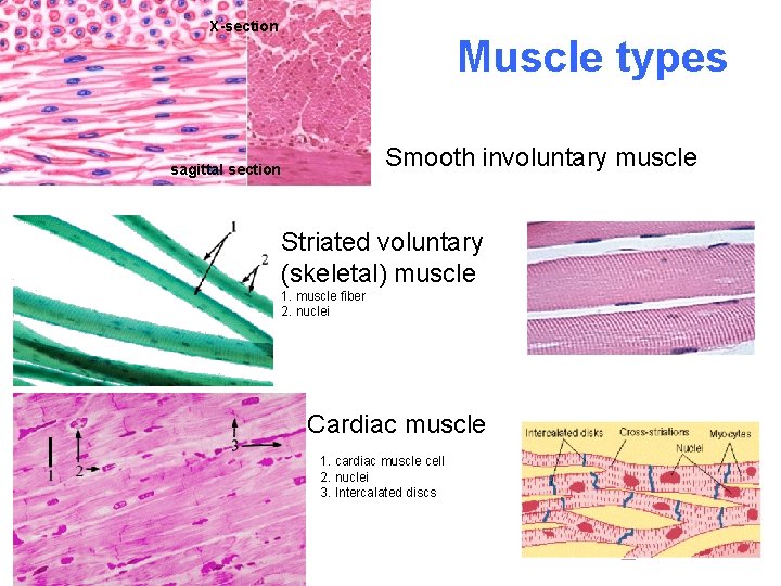 X-section Muscle types Smooth involuntary muscle sagittal section Striated voluntary (skeletal) muscle 1. muscle