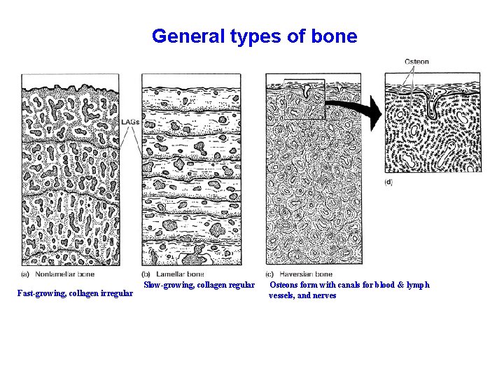 General types of bone Fast-growing, collagen irregular Slow-growing, collagen regular Osteons form with canals