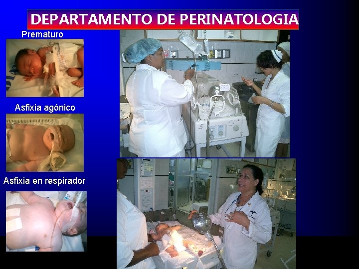 DEPARTAMENTO DE PERINATOLOGIA Prematuro Asfixia agónico Asfixia en respirador 