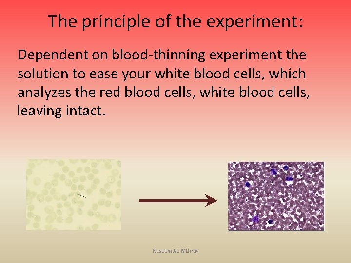 The principle of the experiment: Dependent on blood-thinning experiment the solution to ease your