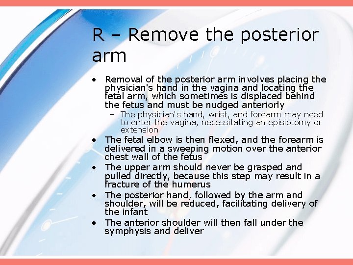 R – Remove the posterior arm • Removal of the posterior arm involves placing