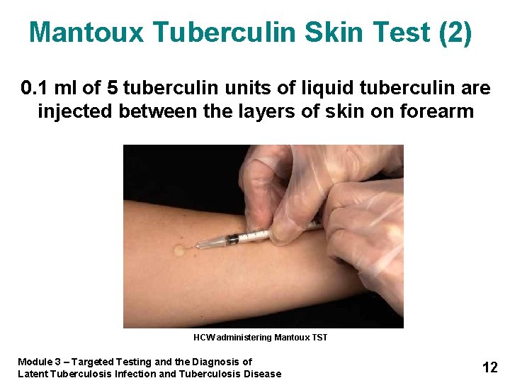 Mantoux Tuberculin Skin Test (2) 0. 1 ml of 5 tuberculin units of liquid