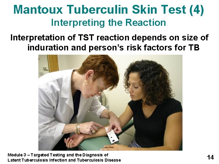 Mantoux Tuberculin Skin Test (4) Interpreting the Reaction Interpretation of TST reaction depends on