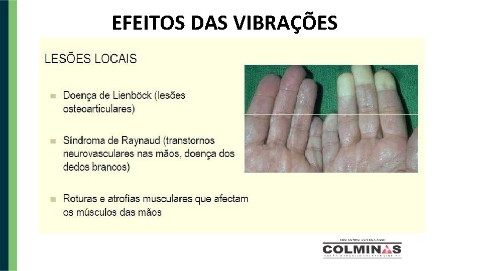 EFEITOS DAS VIBRAÇÕES 