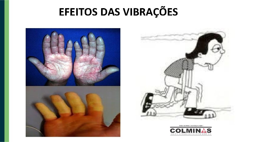 EFEITOS DAS VIBRAÇÕES 