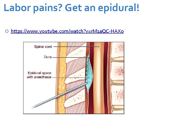 Labor pains? Get an epidural! https: //www. youtube. com/watch? v=r. M 1 a. QC-HAX