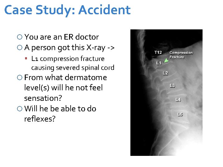 Case Study: Accident You are an ER doctor A person got this X-ray ->