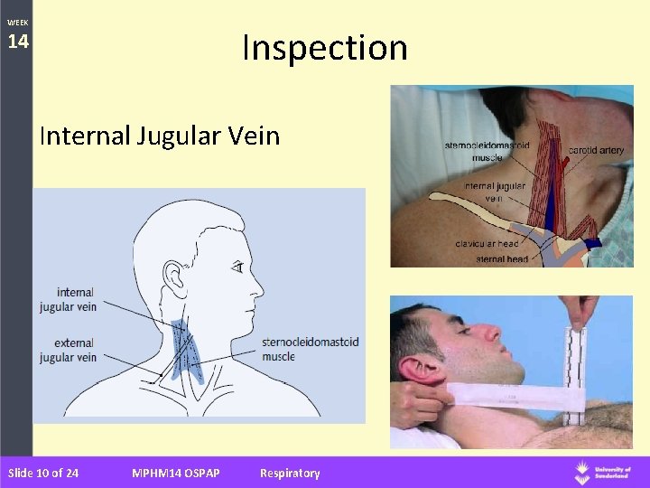 WEEK Inspection 14 Internal Jugular Vein Slide 10 of 24 MPHM 14 OSPAP Respiratory