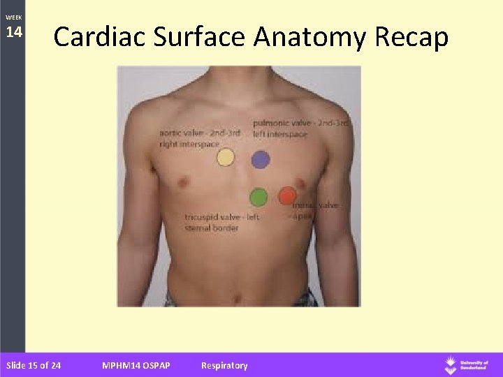 WEEK 14 Cardiac Surface Anatomy Recap Slide 15 of 24 MPHM 14 OSPAP Respiratory