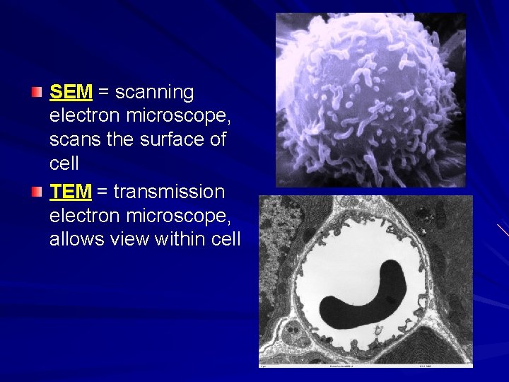 SEM = scanning electron microscope, scans the surface of cell TEM = transmission electron
