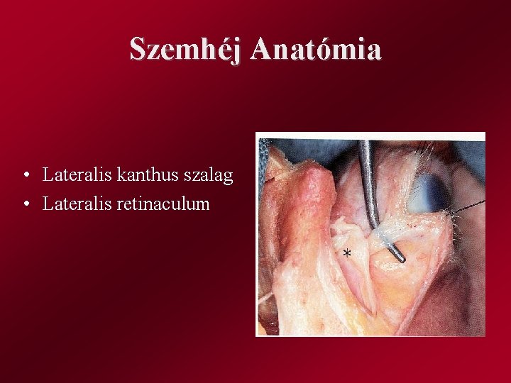 Szemhéj Anatómia • Lateralis kanthus szalag • Lateralis retinaculum 