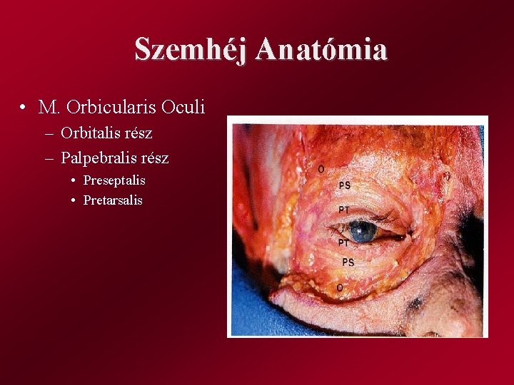 Szemhéj Anatómia • M. Orbicularis Oculi – Orbitalis rész – Palpebralis rész • Preseptalis