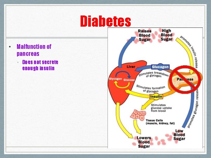 Diabetes • Malfunction of pancreas • Does not secrete enough insulin 