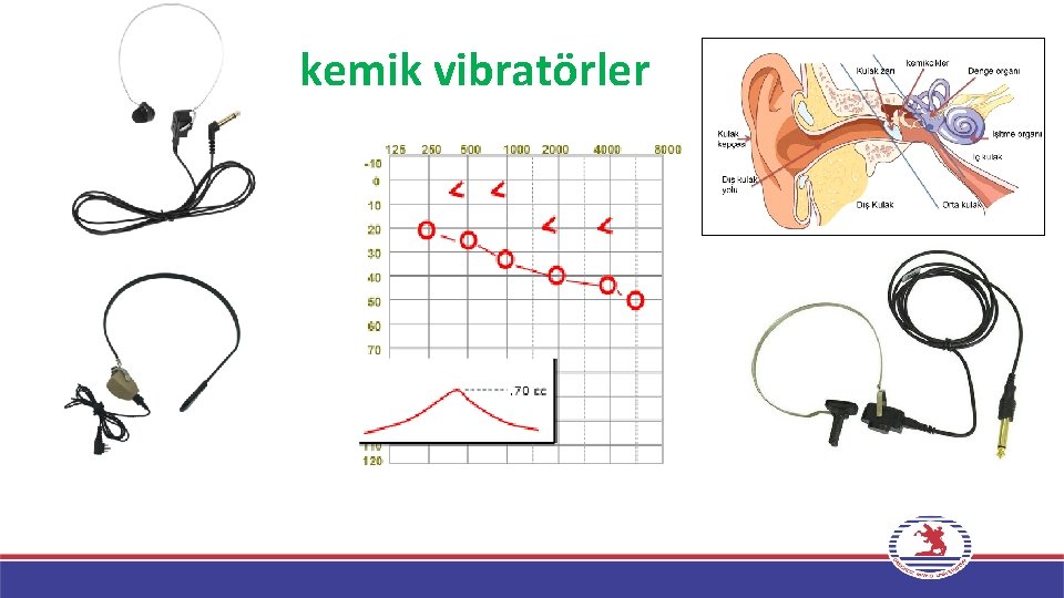 kemik vibratörler 