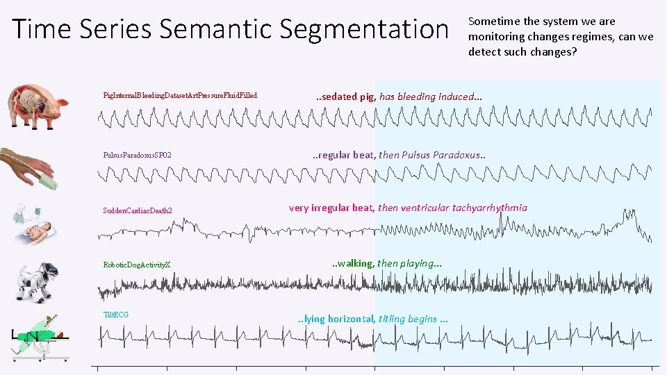 Time Series Semantic Segmentation Pig. Internal. Bleeding. Dataset. Art. Pressure. Fluid. Filled Pulsus. Paradoxus.