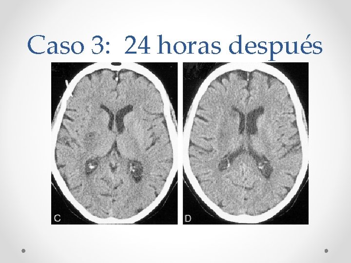 Caso 3: 24 horas después 