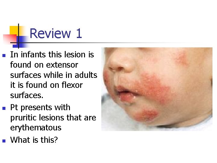 Review 1 n n n In infants this lesion is found on extensor surfaces