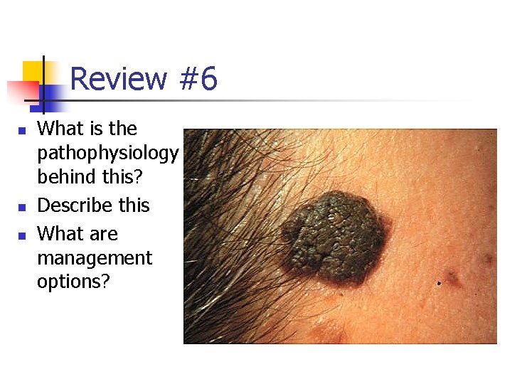 Review #6 n n n What is the pathophysiology behind this? Describe this What