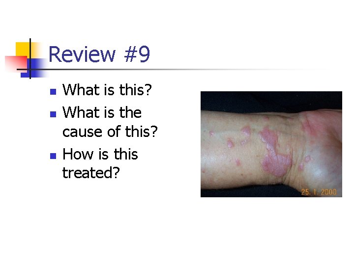 Review #9 n n n What is this? What is the cause of this?