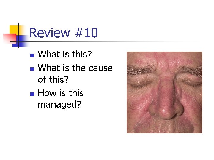 Review #10 n n n What is this? What is the cause of this?