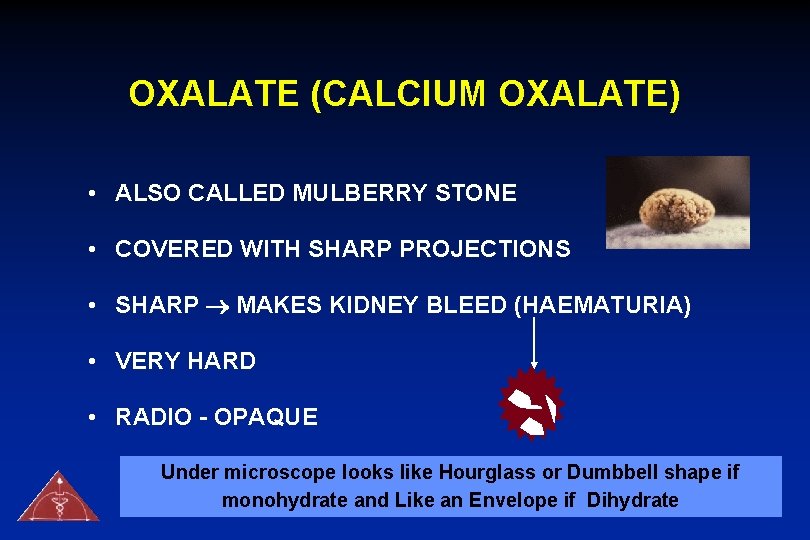 OXALATE (CALCIUM OXALATE) • ALSO CALLED MULBERRY STONE • COVERED WITH SHARP PROJECTIONS •