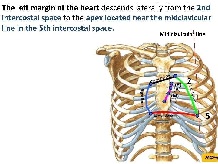 The left margin of the heart descends laterally from the 2 nd intercostal space