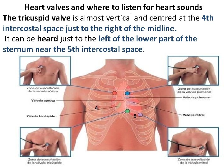 Heart valves and where to listen for heart sounds The tricuspid valve is almost