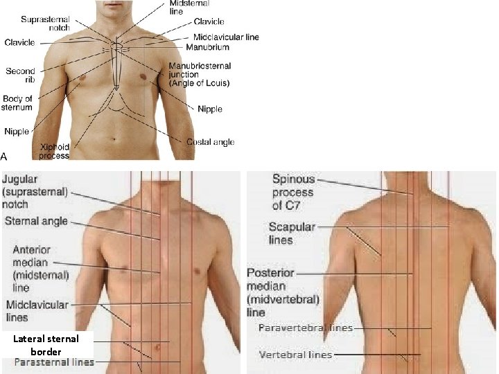 Lateral sternal border 