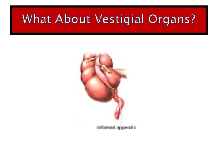What About Vestigial Organs? 