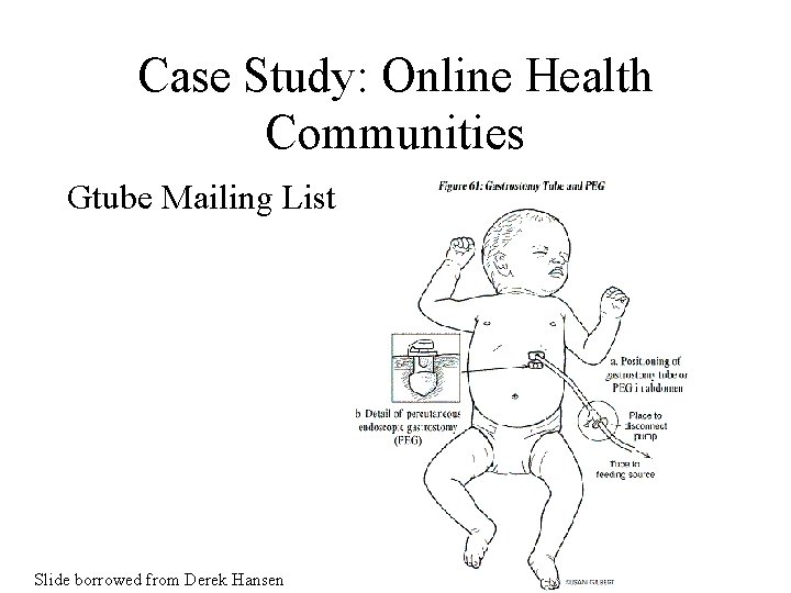 Case Study: Online Health Communities Gtube Mailing List Slide borrowed from Derek Hansen 
