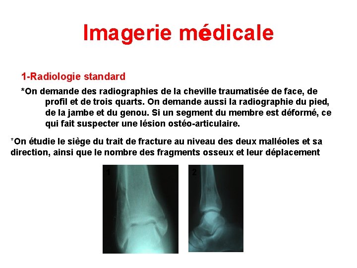 Imagerie médicale 1 -Radiologie standard *On demande des radiographies de la cheville traumatisée de