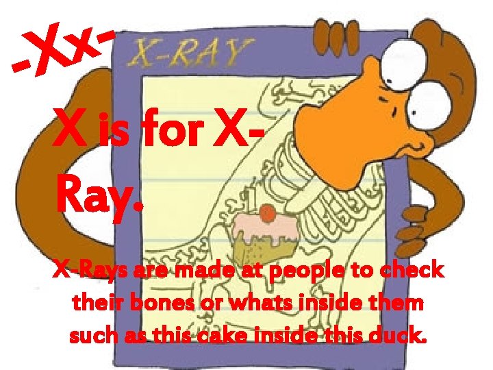 x -X X is for XRay. X-Rays are made at people to check their