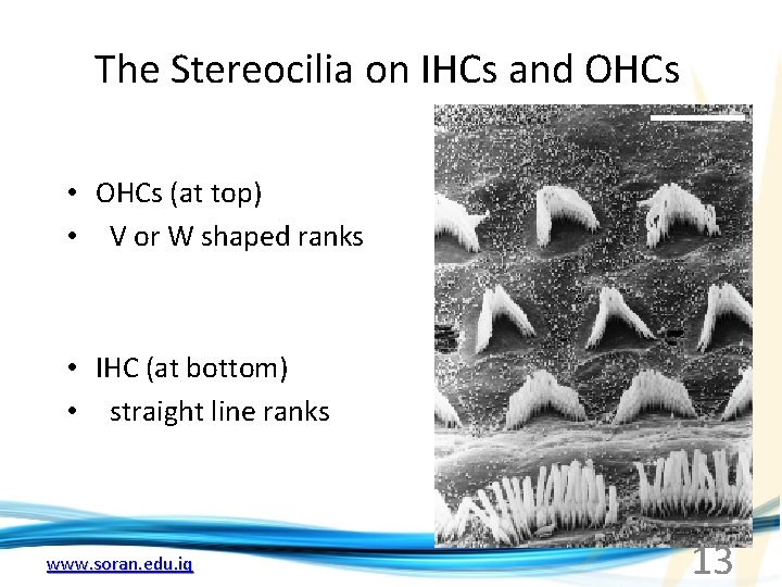 The Stereocilia on IHCs and OHCs • OHCs (at top) • V or W