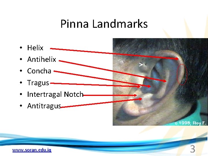 Pinna Landmarks • • • Helix Antihelix Concha Tragus Intertragal Notch Antitragus www. soran.