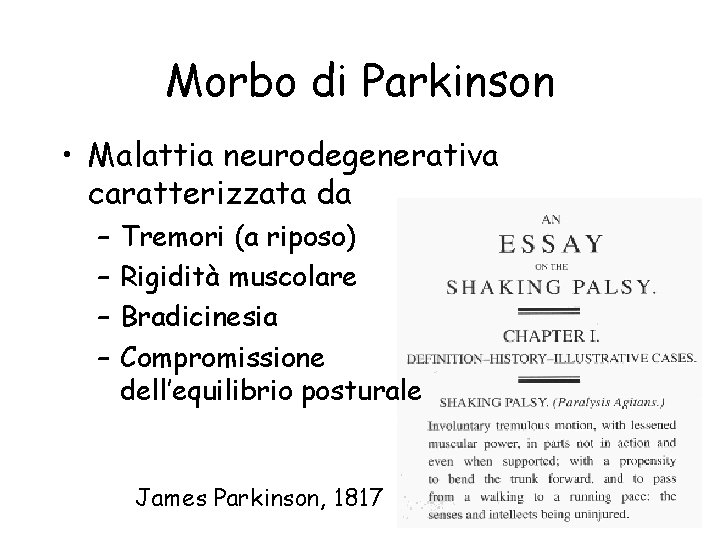 Morbo di Parkinson • Malattia neurodegenerativa caratterizzata da – – Tremori (a riposo) Rigidità