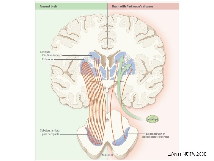 Le. Witt NEJM 2008 