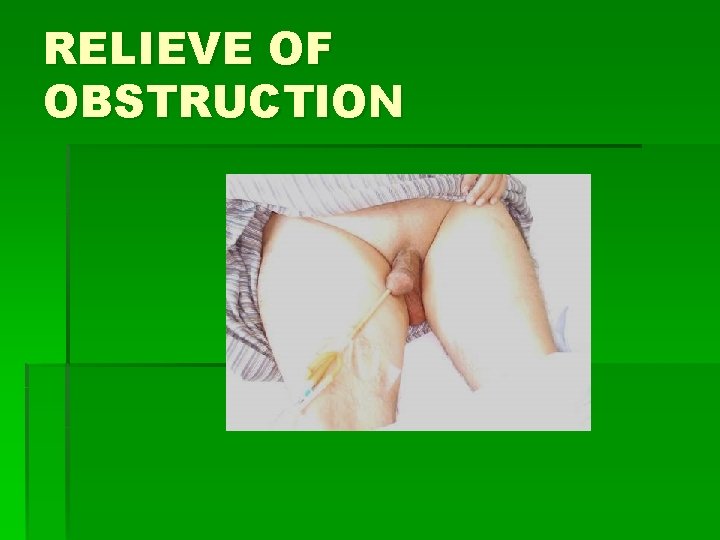 RELIEVE OF OBSTRUCTION 