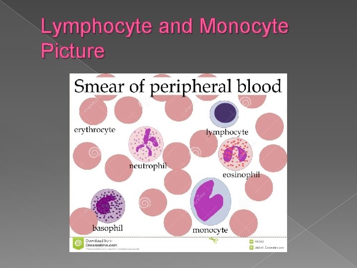 Lymphocyte and Monocyte Picture 