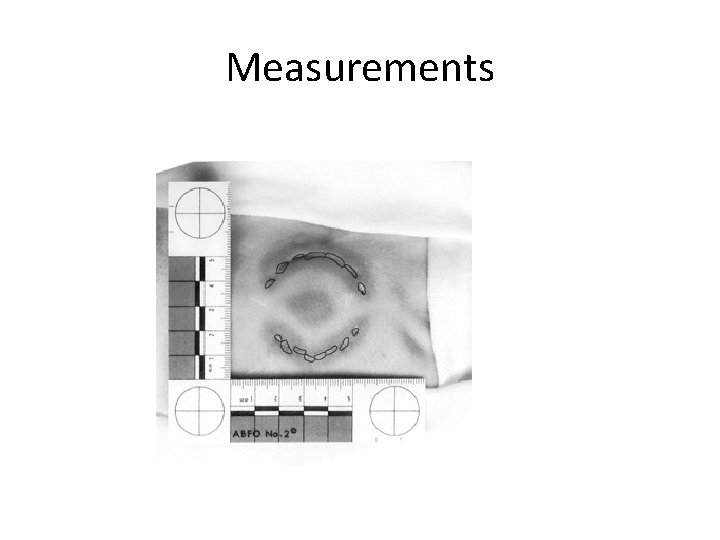 Measurements 
