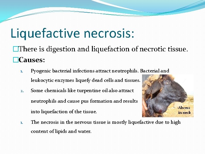 Liquefactive necrosis: �There is digestion and liquefaction of necrotic tissue. �Causes: 1. Pyogenic bacterial