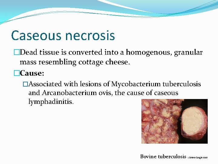Caseous necrosis �Dead tissue is converted into a homogenous, granular mass resembling cottage cheese.