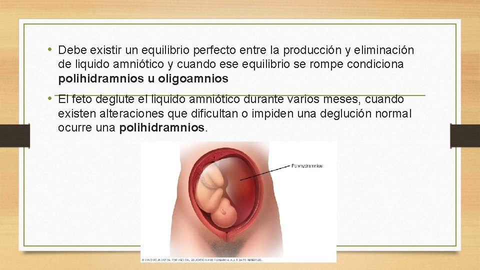  • Debe existir un equilibrio perfecto entre la producción y eliminación de liquido