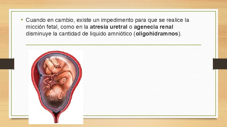  • Cuando en cambio, existe un impedimento para que se realice la micción