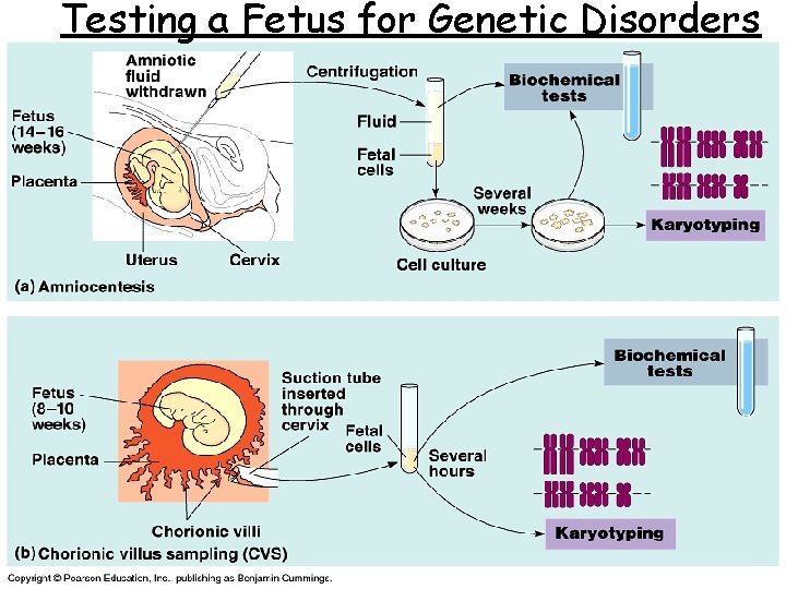 Testing a Fetus for Genetic Disorders 