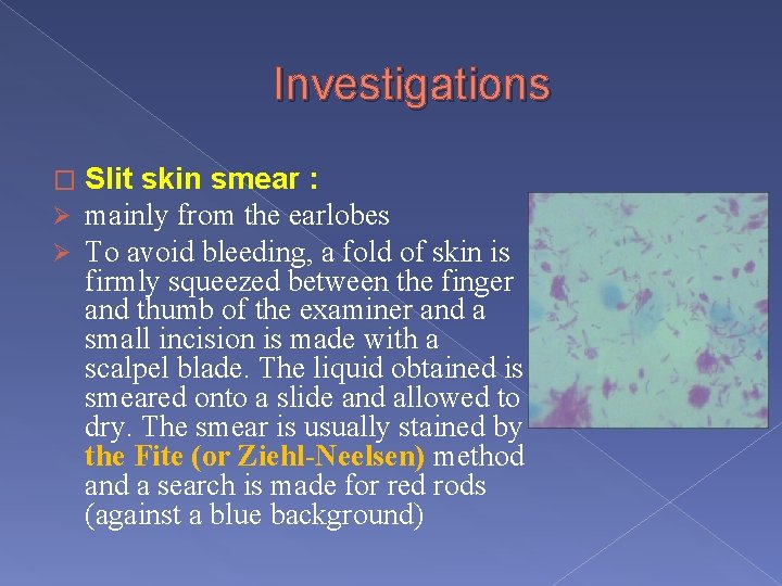 Investigations � Ø Ø Slit skin smear : mainly from the earlobes To avoid